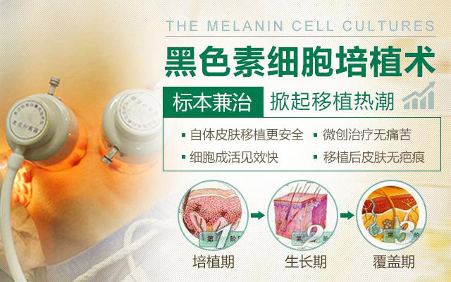 2-1F52Q50244104.jpg